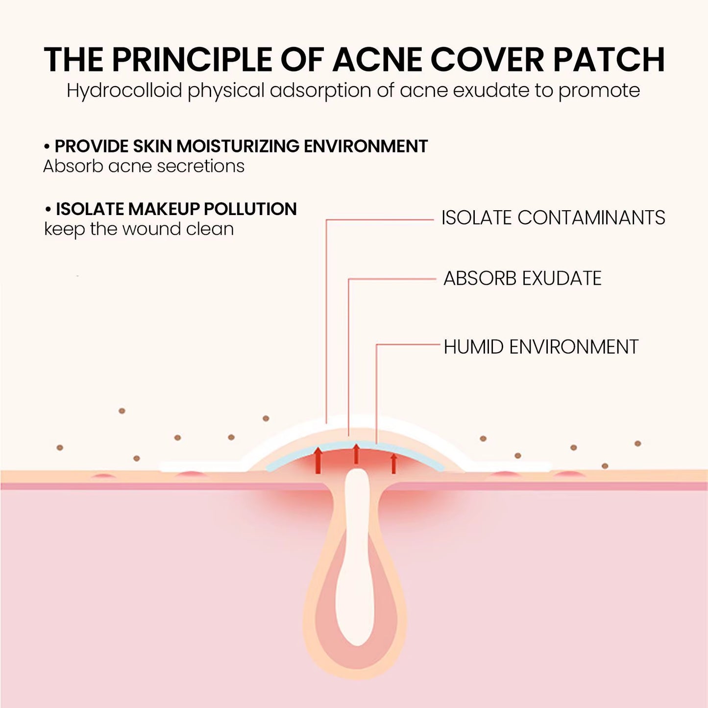 240 Pieces of Multi-Color Star Acne Patches, Facial Acne Patches, Concealer Acne Patches, and Pimples Patches, Ultra-Thin
